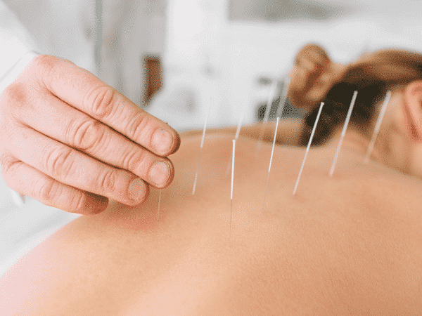 acupuncture for addiction